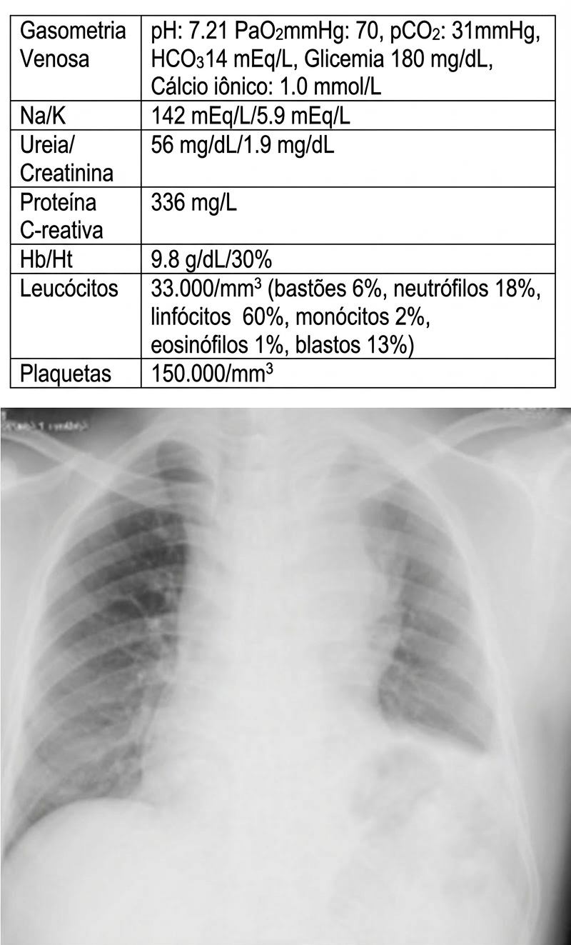Imagem da questão de Infecções Respiratórias Baixas