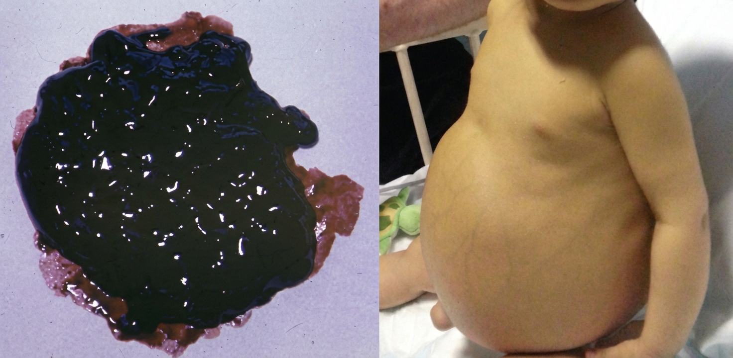 Imagem da questão de Hepatologia