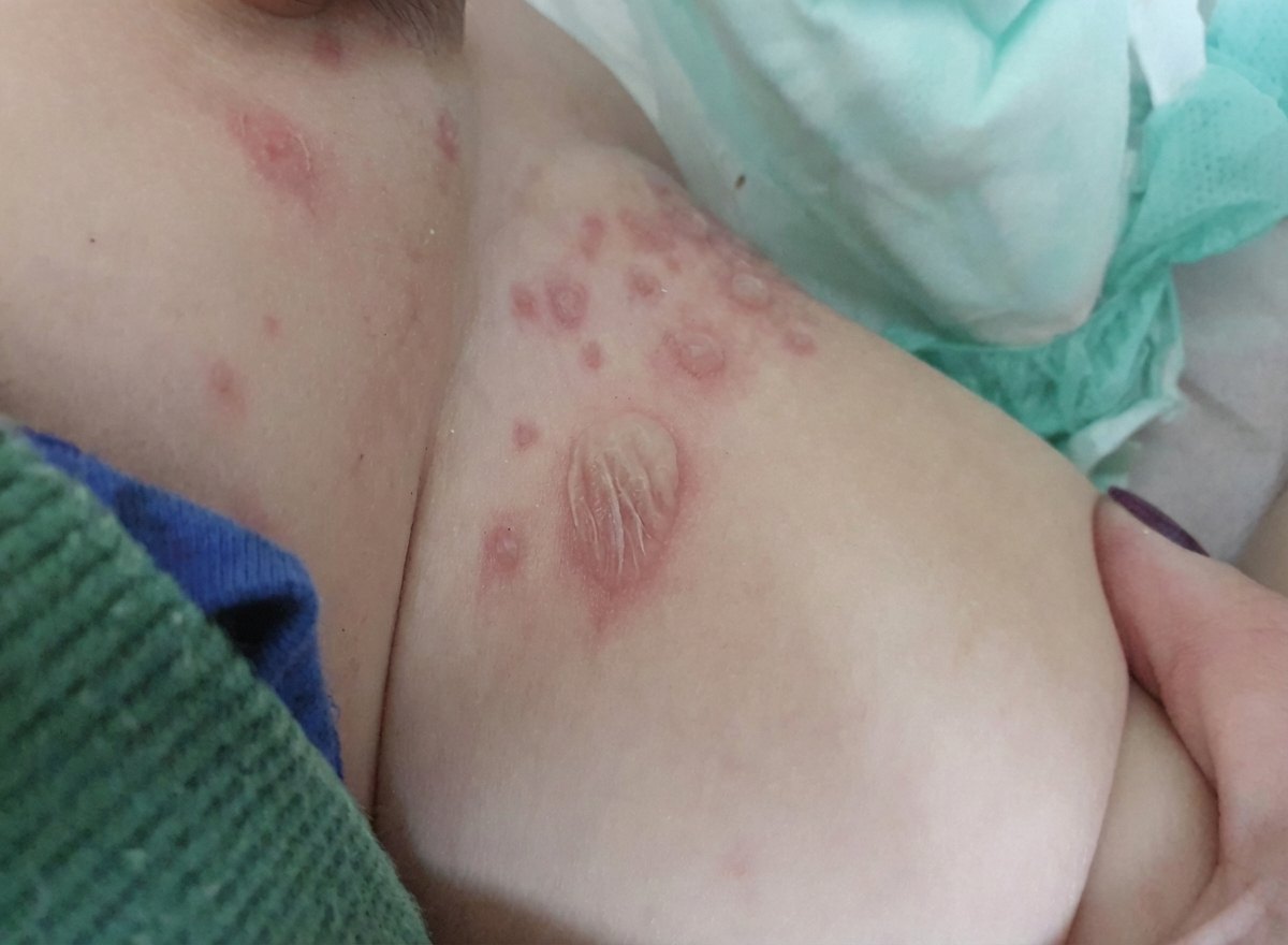 Imagem da questão de Infecções Cutâneas