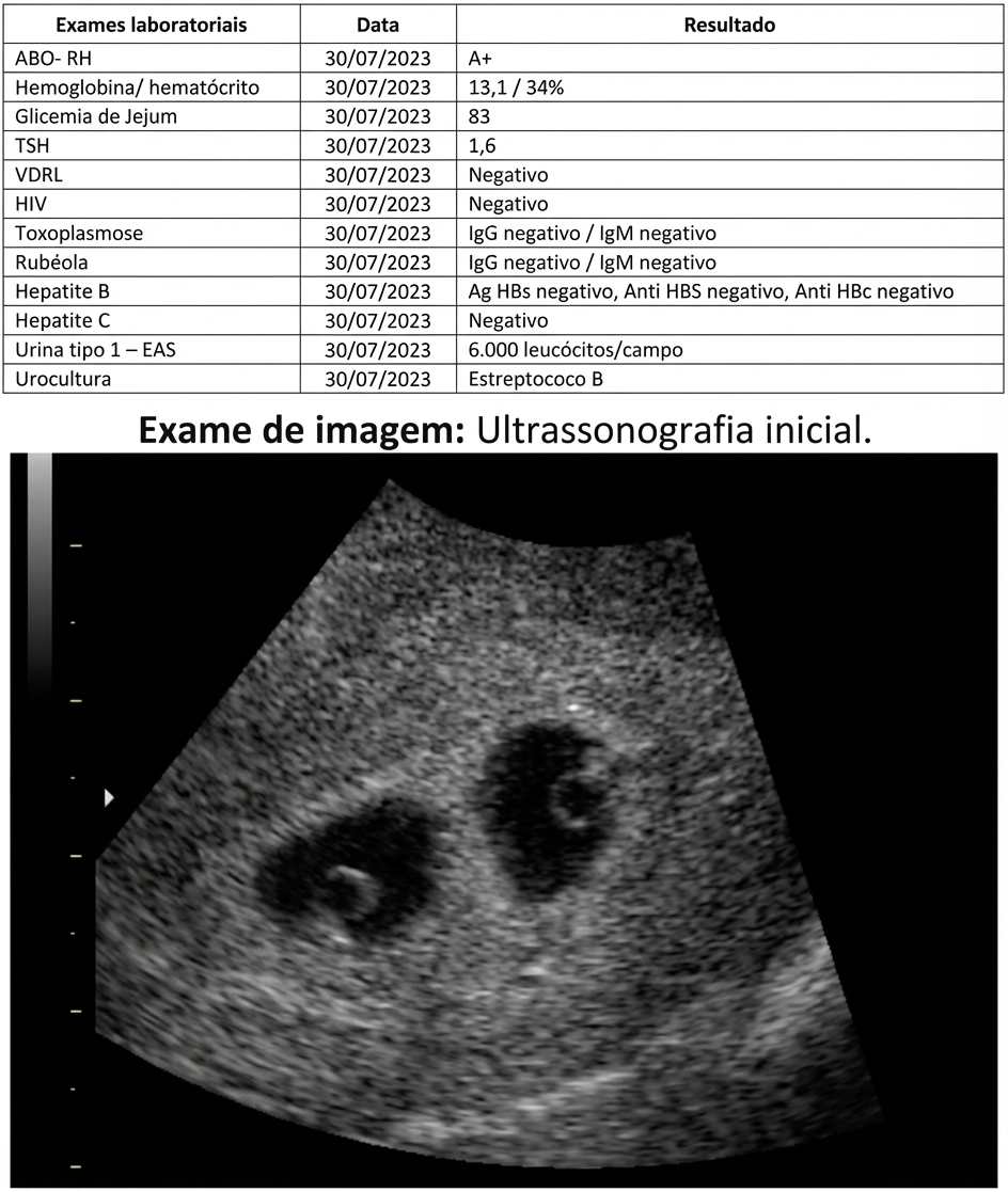 Imagem da questão de Distúrbios Hipertensivos na Gestação