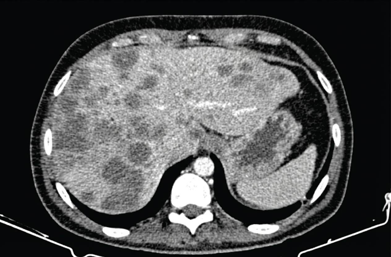 Imagem da questão de Coloproctologia