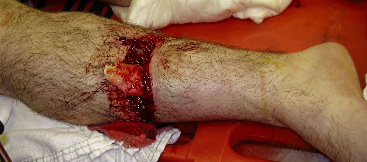Imagem da questão de Trauma Ortopédico