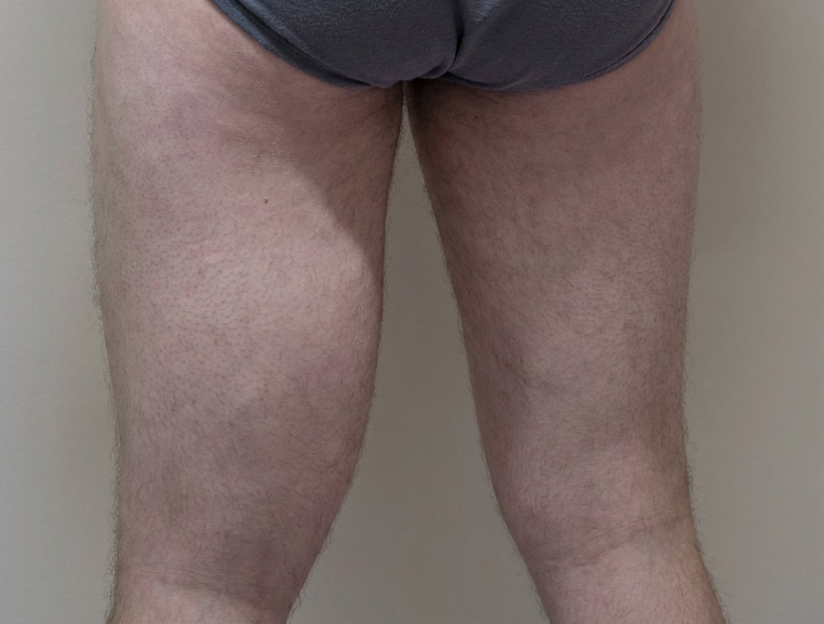 Imagem da questão de Oncologia cirúrgica