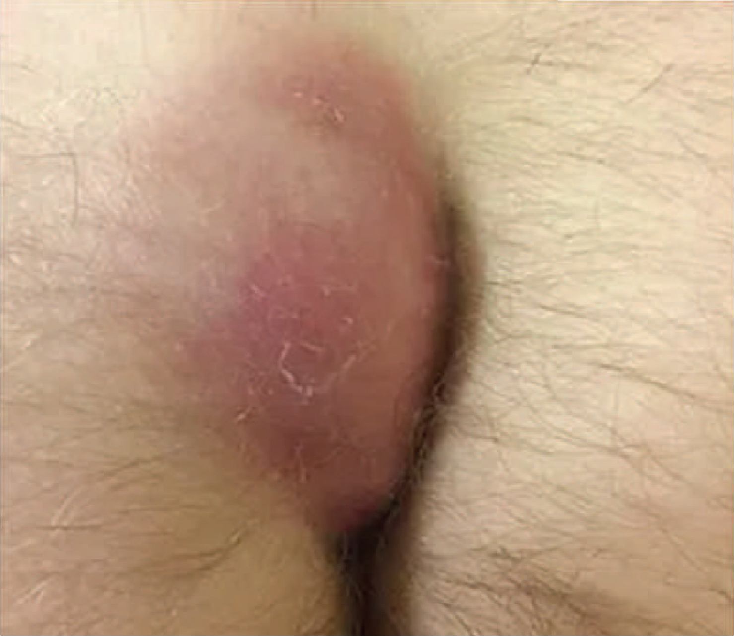 Imagem da questão de Coloproctologia
