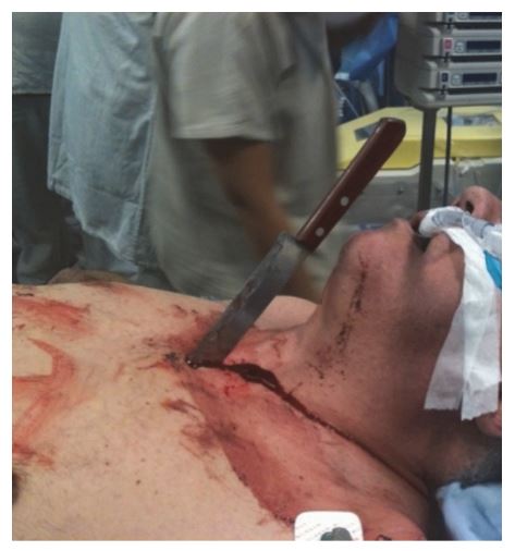 Imagem da questão de Trauma e Emergência