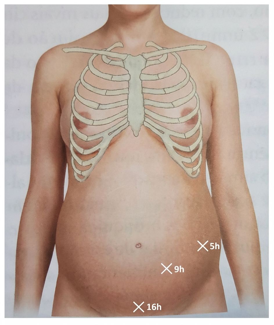 Imagem da questão de Biomecânica do Parto