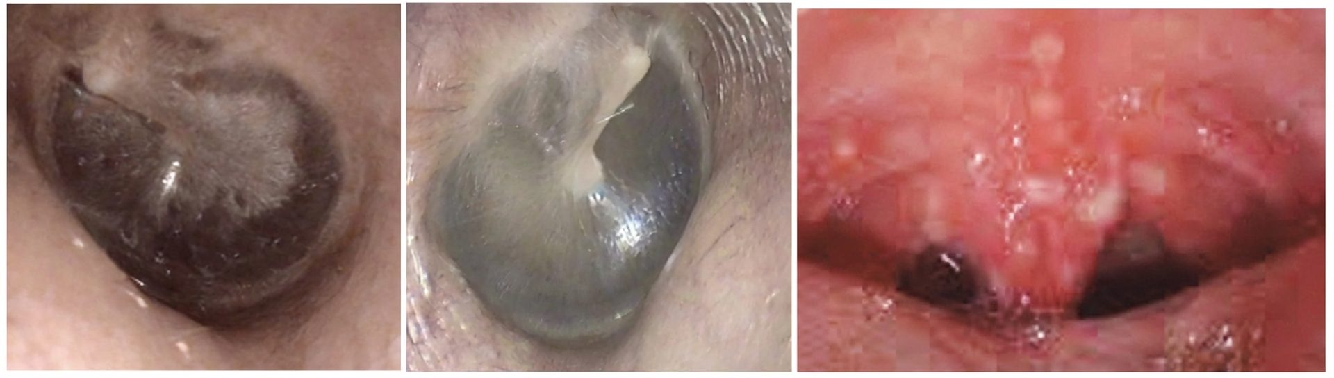 Imagem da questão de Infecções Respiratórias Altas