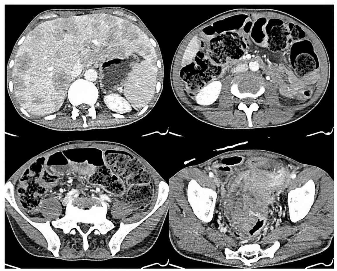 Imagem da questão de Coloproctologia