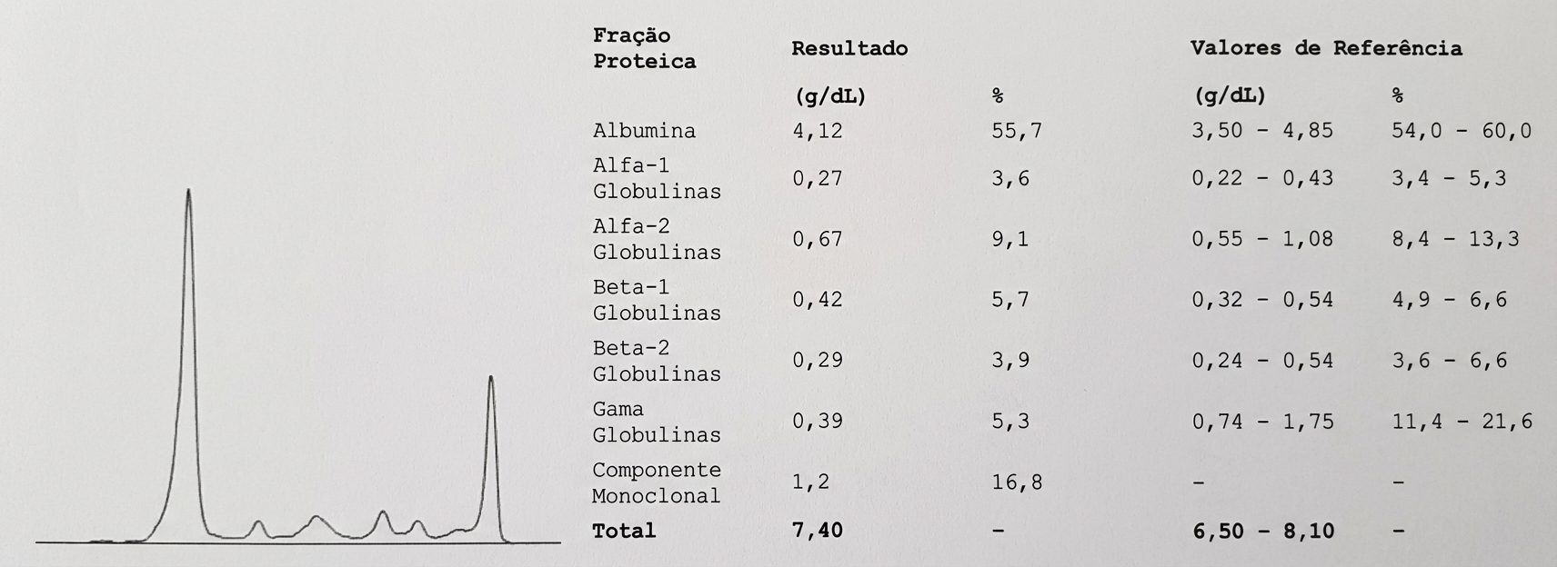 Imagem da questão de Neoplasias Hematológicas