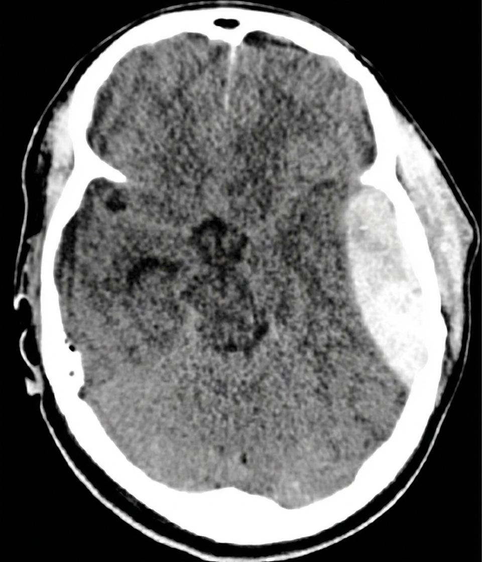 Imagem da questão de Trauma Cranioencefálico (TCE)
