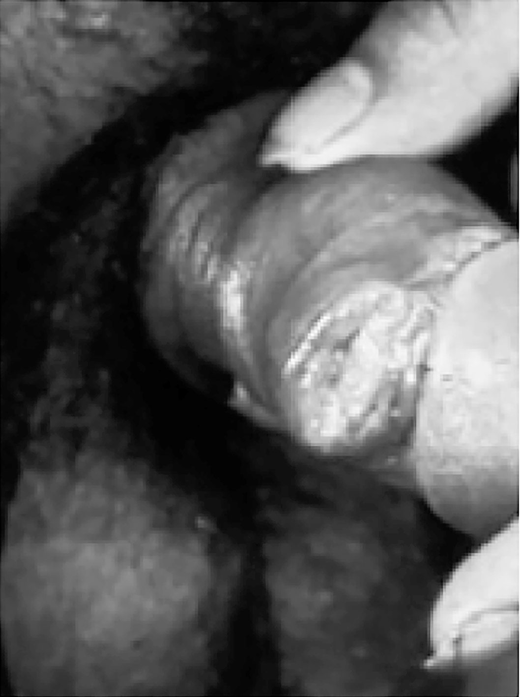 Imagem da questão de Infecções do trato genital